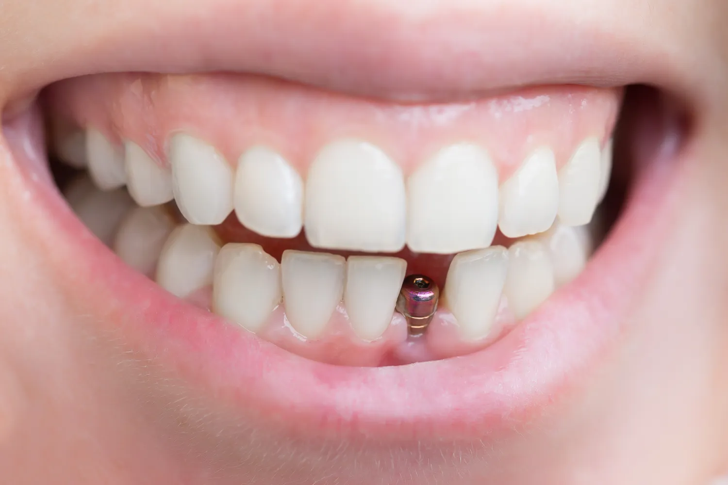 Endodoncja mikroskopowa Szczecin