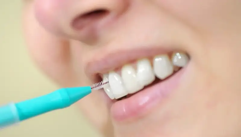Endodoncja Szczecin