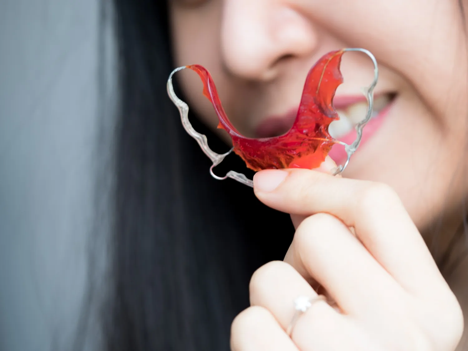Zabiegi dentystyczne refundowane przez NFZ
