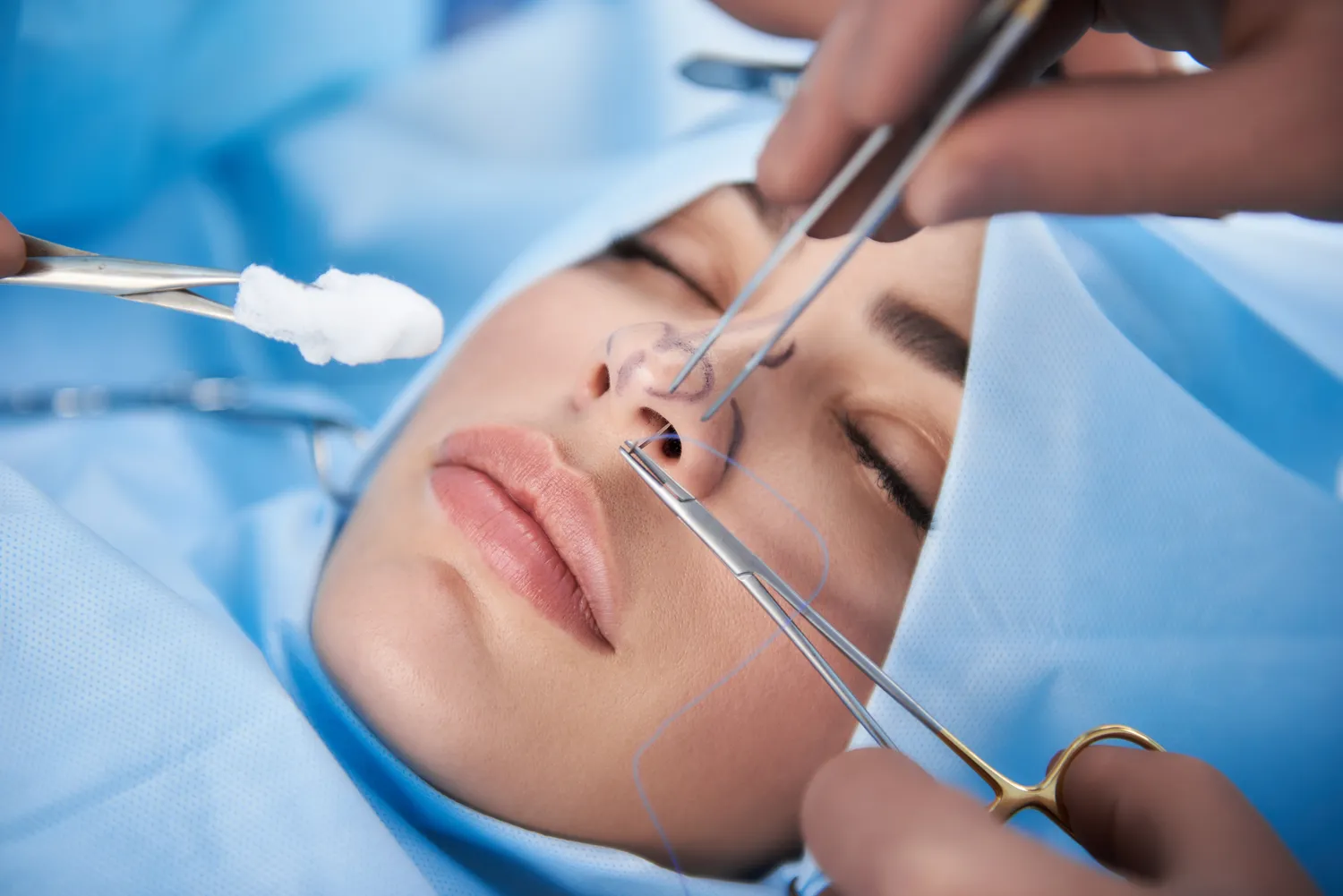 Botox Szczecin