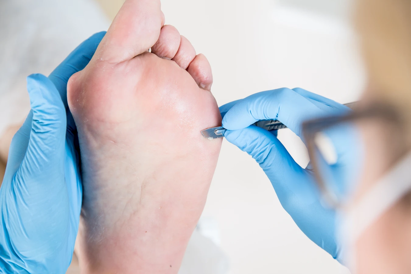 Podologia - pomoc dla stóp
